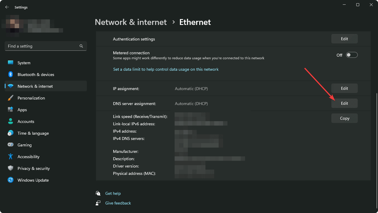 Going edit dns server assignment